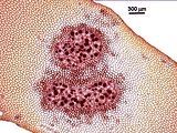 7 - Sori di tetrasporocisti
